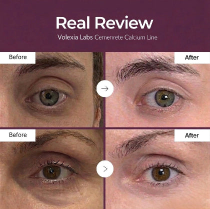 Ionized Calcium Structural Lifting Cream